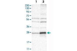 Western Blot analysis of Lane 1: RT-4 and Lane 2: U-251 MG sp cell lysates with CYBRD1 polyclonal antibody . (Cytochrome B Reductase 1 抗体)