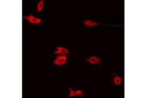 ABIN6272395 staining Hela by IF/ICC. (PXMP4 抗体  (N-Term))