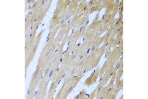 Immunohistochemistry of paraffin-embedded rat heart using ROCK1 antibody at dilution of 1:100 (40x lens). (ROCK1 抗体)