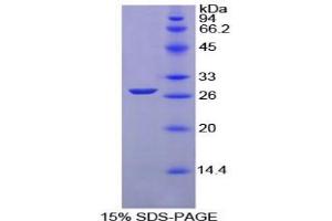 SDS-PAGE analysis of Chicken GSTm1 Protein. (GSTM1 蛋白)