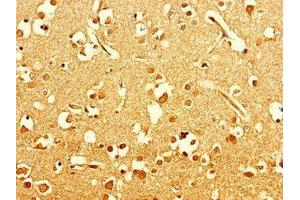 Immunohistochemistry of paraffin-embedded human brain tissue using ABIN7151354 at dilution of 1:100 (ART5 抗体  (AA 45-291))