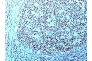 Formalin-fixed, paraffin-embedded human Tonsil stained with Nucleolin Monoclonal Antibody (364-5 + NCL/902). (Nucleolin 抗体)