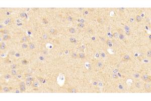 Detection of LDLR in Mouse Cerebrum Tissue using Polyclonal Antibody to Low Density Lipoprotein Receptor (LDLR) (LDLR 抗体  (AA 263-509))