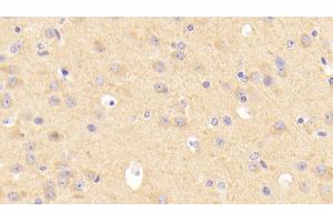 Detection of LDLR in Mouse Cerebrum Tissue using Polyclonal Antibody to Low Density Lipoprotein Receptor (LDLR) (LDLR 抗体  (AA 263-509))