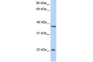 NEK7 antibody used at 1 ug/ml to detect target protein. (NEK7 抗体)