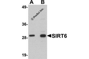 Western Blotting (WB) image for anti-Sirtuin 6 (SIRT6) (C-Term) antibody (ABIN1030666) (SIRT6 抗体  (C-Term))
