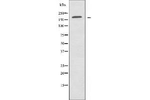 Western blot analysis of extracts from HUVEC cells, using ABCA8 antibody. (ABCA8 抗体  (Internal Region))