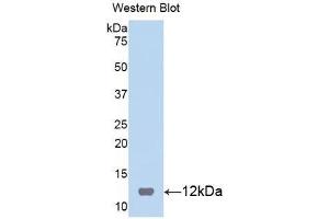 Western Blotting (WB) image for anti-S100 Calcium Binding Protein B (S100B) (AA 1-92) antibody (ABIN1078517) (S100B 抗体  (AA 1-92))