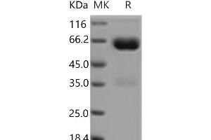 Western Blotting (WB) image for Leukocyte Immunoglobulin-Like Receptor, Subfamily A (With TM Domain), Member 5 (LILRA5) protein (Fc Tag) (ABIN7321121)