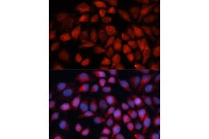 Immunofluorescence analysis of HeLa cells using ACADM antibody (ABIN3015656, ABIN3015657, ABIN1678521 and ABIN6219006) at dilution of 1:100 (40x lens). (Medium-Chain Specific Acyl-CoA Dehydrogenase, Mitochondrial (AA 1-220) 抗体)