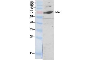 Western Blotting (WB) image for anti-Cytochrome C Oxidase Subunit II (COX2) antibody (ABIN5959232) (COX2 抗体)