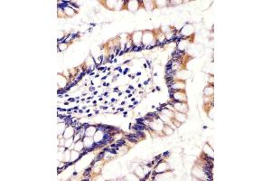 (ABIN655163 and ABIN2844780) staining CYP11B2 in human small intestine tissue sections by Immunohistochemistry (IHC-P - paraformaldehyde-fixed, paraffin-embedded sections). (CYP11B2 抗体  (AA 120-147))