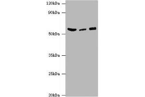 Western blot All lanes: HARS antibody at 6 μg/mL Lane 1: Hela whole cell lysate Lane 2: K562 whole cell lysate Lane 3: 293T whole cell lysate Secondary Goat polyclonal to rabbit IgG at 1/10000 dilution Predicted band size: 58, 53, 51, 55 kDa Observed band size: 58 kDa (HARS1/Jo-1 抗体  (AA 1-180))