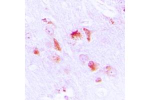 Immunohistochemical analysis of Apolipoprotein L2 staining in human brain formalin fixed paraffin embedded tissue section. (Apolipoprotein L 2 抗体  (Center))