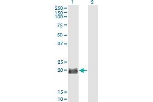 Western Blot analysis of EXOSC1 expression in transfected 293T cell line by EXOSC1 monoclonal antibody (M01), clone 2E9. (EXOSC1 抗体  (AA 1-195))