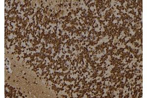 ABIN6261257 and ABIN6277502 at 1/100 staining Rat brain tissue by IHC-P. (DDX5 抗体  (C-Term))