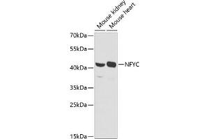 Western blot analysis of extracts of various cell lines, using NFYC antibody (ABIN6129066, ABIN6144604, ABIN6144605 and ABIN6225149) at 1:1000 dilution. (NFYC 抗体  (AA 86-335))