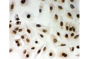 ICC testing of Lamin A antibody and A549 cells (Lamin A/C 抗体  (AA 481-646))