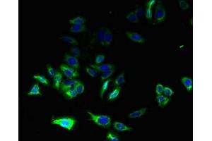 anti-CYBC1 (AA 43-187) antibody