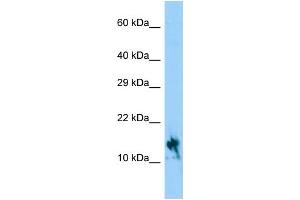 Host: Rabbit Target Name: IGFL1 Sample Type: Hela Whole Cell lysates Antibody Dilution: 1. (IGFL1 抗体  (C-Term))