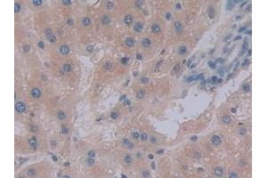Detection of ENPEP in Rat Liver Tissue using Polyclonal Antibody to Aminopeptidase A (ENPEP)