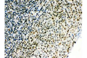 Anti- CTBP1 Picoband antibody, IHC(P) IHC(P): Human Tonsil Tissue (CTBP1 抗体  (C-Term))