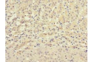 Immunohistochemistry of paraffin-embedded human adrenal gland tissue using ABIN7176327 at dilution of 1:100 (ZNF462 抗体  (AA 2223-2506))
