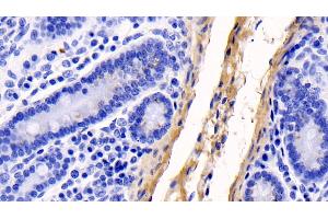 Immunohistochemistry (IHC) image for anti-Collagen, Type I, alpha 1 (COL1A1) (AA 253-471) antibody (ABIN7428014)