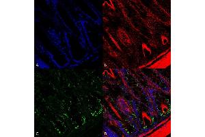 Immunohistochemistry analysis using Mouse Anti-O-GalNAc Monoclonal Antibody, Clone 9B9 (ABIN5067145). (O-GalNAC 抗体)