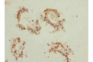 Immunohistochemistry (IHC) image for anti-Eukaryotic Translation Initiation Factor 2B, Subunit 1 Alpha, 26kDa (EIF2B1) (AA 1-305) antibody (ABIN7172902)