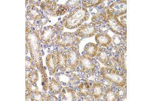 Immunohistochemistry (Paraffin-embedded Sections) (IHC (p)) image for anti-Anaphase Promoting Complex Subunit 5 (ANAPC5) (AA 1-250) antibody (ABIN6136867)