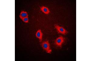 Immunofluorescent analysis of Caspase 9 staining in HeLa cells. (Caspase 9 抗体  (Center))