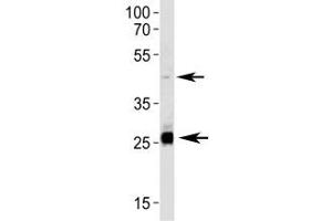 Western Blotting (WB) image for anti-Sirtuin 3 (SIRT3) (AA 250-279) antibody (ABIN3032590)