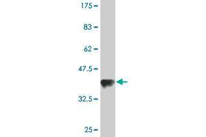Western Blot detection against Immunogen (36. (TARS 抗体  (AA 44-143))