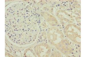 Immunohistochemistry of paraffin-embedded human kidney tissue using ABIN7173395 at dilution of 1:100 (TMLHE 抗体  (AA 16-376))
