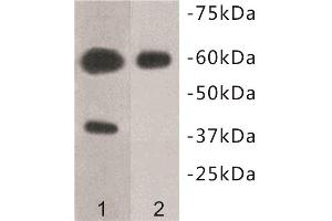 Western Blotting (WB) image for anti-Transmembrane Protein 57 (TMEM57) antibody (ABIN1854993) (TMEM57 抗体)
