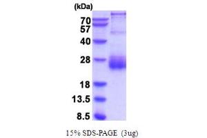 SDS-PAGE (SDS) image for serine Peptidase Inhibitor, Kunitz Type, 2 (SPINT2) (AA 28-197) protein (His tag) (ABIN5854267) (SPINT2 Protein (AA 28-197) (His tag))