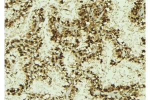 ABIN6273146 at 1/100 staining Human lung tissue by IHC-P. (NUFIP1 抗体  (Internal Region))