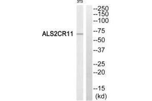 Western blot analysis of extracts from NIH/3T3 cells, using ALS2CR11 antibody. (C2 Calcium-Dependent Domain-Containing Protein 6 (C2CD6) (C-Term) 抗体)