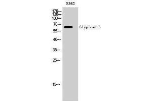 Western Blotting (WB) image for anti-Glypican 5 (GPC5) (Internal Region) antibody (ABIN3175297) (GPC5 抗体  (Internal Region))