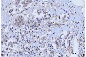 IHC analysis of RAD51C using anti-RAD51C antibody (ABIN7599718).