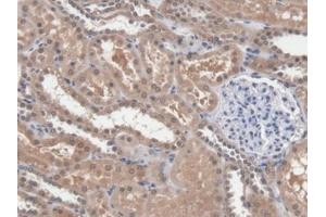 Immunohistochemistry (IHC) image for anti-Dicer 1, Ribonuclease Type III (DICER1) (AA 6-290) antibody (ABIN7436789)