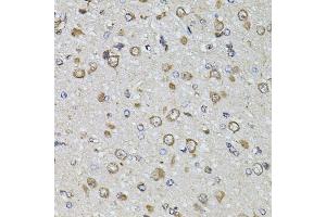 Immunohistochemistry of paraffin-embedded rat brain using FGF2 antibody. (FGF2 抗体)