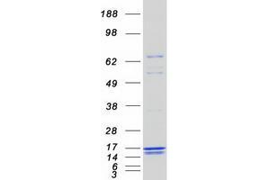 Western Blotting (WB) image for Caspase Recruitment Domain Family, Member 16 (CARD16) (Transcript Variant 2) protein (Myc-DYKDDDDK Tag) (ABIN2713161)