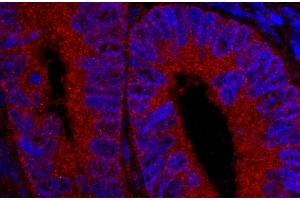 Immunofluorescence (IF) image for anti-Ubiquitin Specific Peptidase 5 (USP5) (AA 375-425) antibody (ABIN7449032) (USP5 抗体  (AA 375-425))