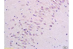 Formalin-fixed and paraffin embedded rat brain labeled with Anti Substance P Receptor/NK1R Polyclonal Antibody, Unconjugated  at 1:200 followed by conjugation to the secondary antibody Goat Anti-Rabbit IgG, PE conjugated -PE)used at 1:200 dilution for 40 minutes at 37°C. (TACR1 抗体  (AA 2-50))