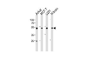 ENOA Antibody (C-term) (ABIN1882077 and ABIN2839495) western blot analysis in Jurkat,MCF-7, cell line and mouse brain tissue lysates (35 μg/lane). (ENO1 抗体  (C-Term))