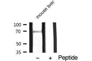 Western Blotting (WB) image for anti-Protein Kinase C, zeta (PRKCZ) (pThr410) antibody (ABIN6256558)