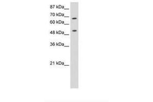 Image no. 3 for anti-THO Complex 1 (THOC1) (AA 511-560) antibody (ABIN6736250) (THOC1 抗体  (AA 511-560))