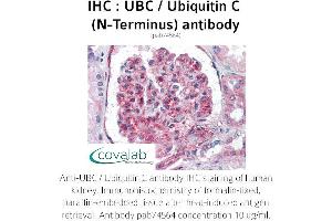 Image no. 1 for anti-Ubiquitin C (UBC) (N-Term) antibody (ABIN4889895) (UBC 抗体  (N-Term))